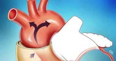 باحثون أمريكيون يتوصلون لزرع شريحة بالقلب تحميه من التوقف