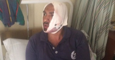 حارس عقار يشوه وجه موظف إشغالات فى حى العمرانية بـ"شيشة"