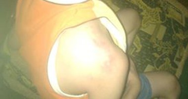 صحافة المواطن.. معلمة بمدرسة الأمل فى بشتيل تعتدى على طالب بالضرب المبرح