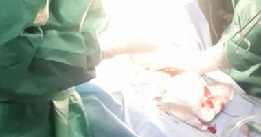 جراحة دقيقة بالصدر لطفل بـ"طوارئ" مستشفى العامرية