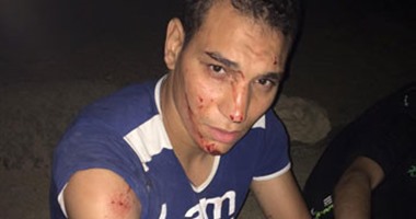 بالصور.. لاعب الأهلى السابق ينشر صور تعرضه لحادث