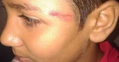 التحقيق مع معلمة تعدت على طالب بضربه على وجهه فى كفر الشيخ