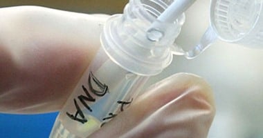لغز الـDNA.. الشفرة الوراثية التي لا تخطئ في فك طلاسم جرائم القتل