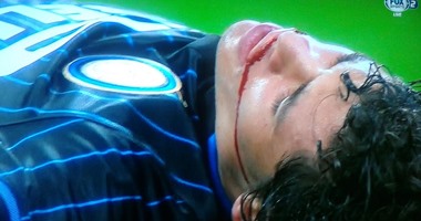 تدخل دموى فى ديربى ميلانو