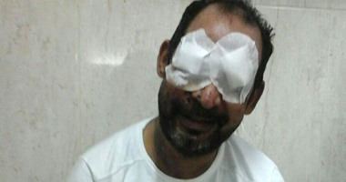 آخر الرجال المحترمين..مواطن يدفع نور عينيه ثمنا لشهامته..تدخل للدفاع عن فتاة فأطلق مسلحون النار عليه ففقد بصره..ويؤكد لليوم السابع:"اللى عملته واجب وأحتسب عينى عند الله".. والداخلية تعالجه على نفقتها