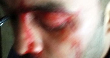 اجتماع طارئ لـ"محامى القليوبية" اليوم لبحث تطورات الاعتداء على محامى شبرا