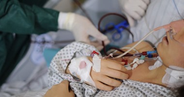 أستاذ جراحة: زراعة القلب الحل الأمثل لعلاج "وحيد البطين"