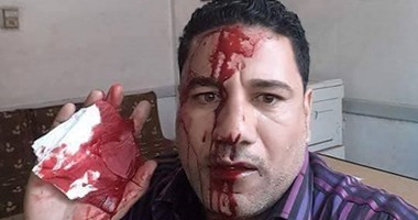 إصابة موظفين بمجلس مدينة الإبراهيمية فى مشاجرة بالأسلحة البيضاء