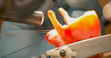 مفاجأة.. علماء يبتكرون أحبالا صوتية فى المختبر تعطى أملاً للمرضى