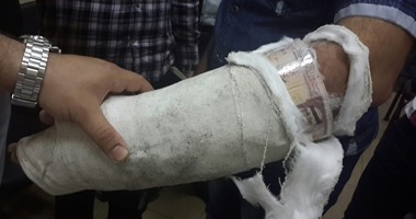 بالصور.. القبض على راكب حاول تهريب 270 ألف ريال تحت جبيرة جبس فى ذراعه