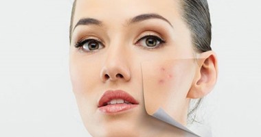 6 طرق لتجنب مشاكل البثور وفقاعات الماء فى الجلد خلال الصيف.. تعرف عليها