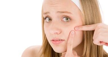 6 نصائح للوقاية من حب الشباب