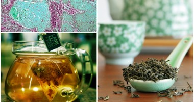 فوائد البابونج لصحة الجسم والبشرة