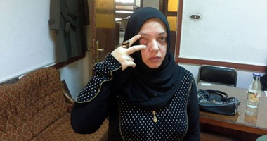 بالصور.. مأساة زوجة رفضت العودة لطليقها بعد 5 سنوات عذاب.. شيماء: خطفنى وسكب مياه نار فى عينى وأجبرنى على شربها.. وتستغيث: طليقى هددنى بالقتل وأجريت 4 عمليات وأحتاج للسفر للخارج
