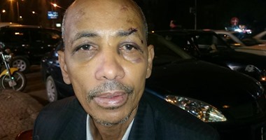 بلاغ من كيميائى يمنى يتهم مدرسا أمريكيا بالتعدى عليه فى فندق بالعجوزة