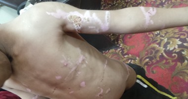 حبس مالك العقار المتهم بتعذيب طفل المرج