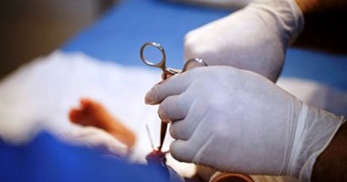 "الأمريكية لمكافحة الأمراض": ختان الذكور سبب رئيسى فى الوقاية من الإيدز