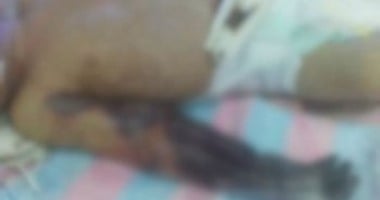 حبس طبيب 4 أيام تسبب فى وفاة رضيع بكفر الشيخ