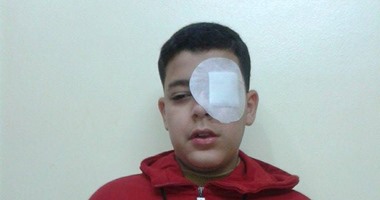 استمرارا لمسلسل الإهمال فى المدارس.. تلميذ يضرب زميله مريض السكر ويصيبه بقرحة بعينه داخل مدرسة بطنطا.. والد الطفل: المدير رفض سابقا إعطاءه جرعة الأنسولين..ويطالب وكيل الوزارة بالغربية بمحاسبة المقصرين