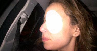 إصابة عين ريم البارودى أثناء تصوير "زجزاج"