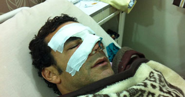الحضرى يرتدى "قناع" بعد "جراحة الأنف"