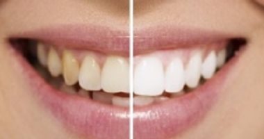 وداعا للرعب من طبيب الأسنان..ابتكار بخاخة بنج عن طريق الأنف تغنى عن الحقن