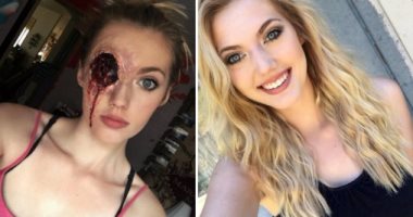 مش بس للتجميل..فتاة أمريكية تستخدم الماكياج فى خدع  تشويه البشرة 