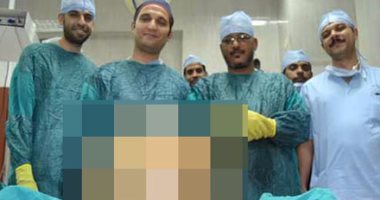استئصال ورم سرطانى يزن 38 كيلو من بطن عجوز بجامعة أسيوط