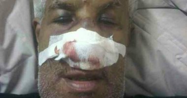 المصرى ضحية التعصب الدينى والعنصرى فى إيطاليا يكشف: شرطة روما رفضت القبض على الجناة.. محمد سعد: مكتب العمل شطب اسمى ورفض صرف معاشى بعد فقد عينى..ويؤكد: ربطوا قضيتى بمقتل "ريجينى" بعد مكالمة الإبراشى 
