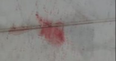 قارئ يشكو من الإهمال الطبى لوالدته المريضة بمستشفى الزهراء الجامعى 