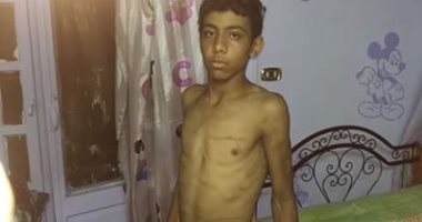 نجدة الطفل يتلقى بلاغا بتعذيب أب لابنه البالغ من العمر 12 عاما لرفضه النزول للعمل