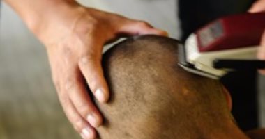 استياء من حملة بريطانية لحلق الرأس..متعافون من السرطان:أعادت ذكريات أليمة