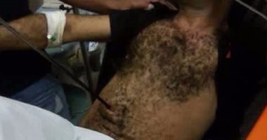 بعد طعنه بـ"سيخ" فى بطنه.. عامل ديلفرى: الكبابجى طعننى أثناء توصيلى الطلبات