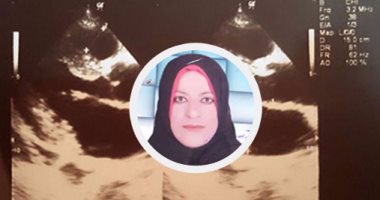 بالصور.. مأساة فتاة بالشرقية تحتاج لزراعة كلى بـ100 ألف جنيه