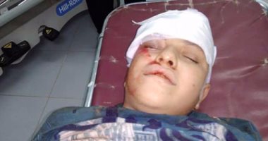 إصابة طفل صدمته سيارة وهرب سائقها فى الوادى الجديد