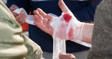 ابتكار مسحوق قابل للرش يمكنه إيقاف النزيف الحاد خلال ثوانٍ