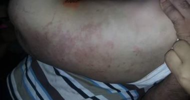 بالصور..ربة منزل تساعد زوجها الثانى فى تعذيب طفلتها بسبب بكائها بالشرقية