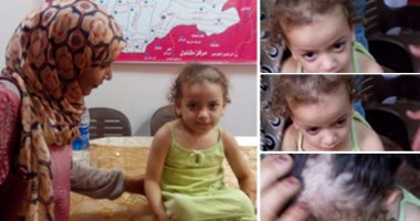 بالفيديو والصور.. أبشع جريمة تعذيب بالشرقية.. أم تعذب ابنتها من الزوج الأول.. والطفلة: جوز ماما كان بيسخن المعلقة على النار ويلسعنى فى جسمى ويقطع شعرى عشان كنت جعانة.. النيابة تأمر بحبس المتهمين 4أيام