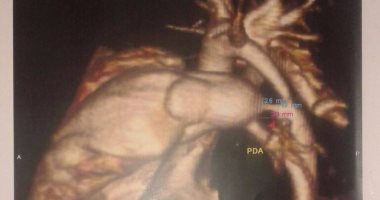 بالصور.. مواطن يستغيث بوزير الصحة لإنقاذ حياة رضيعه