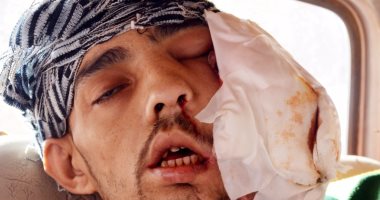 مريض بالسرطان بالغربية: "معهد أورام طنطا رفض دخولى لأن رائحتى وحشة"