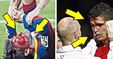 بالفيديو.. 10 إصابات مرعبة تعرض لها ميسي ورونالدو فى الملاعب
