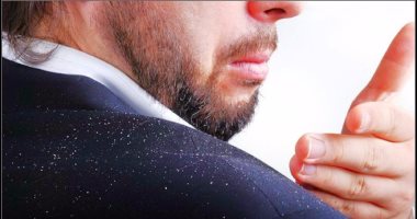 6 خطوات تحمى شعرك من قشرة الرأس.. أهمها ماسك "البابونج"