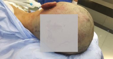 بالصور.. الاعتداء على طفل بألة حادة واصابته فى رأسه بكفر صقر فى الشرقية 