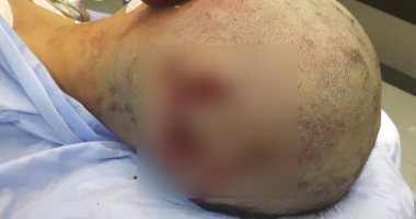  نيابة الشرقية تقرر تسليم الشاهد فى واقعة الطفل يوسف الألفى إلى أسرته