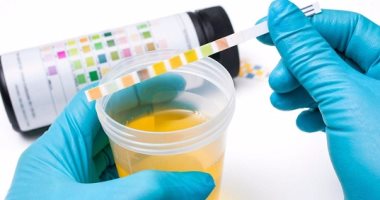 علاج فعال لحب الشباب.. البول أحدث تقاليع التجميل فى العالم 