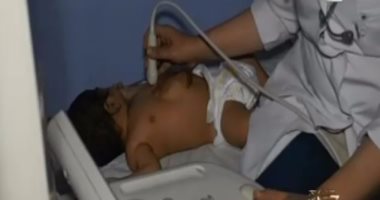 بالفيديو.. لحظة وصول الطفل صاحب القلب خارج القفص الصدرى لمركز مجدى يعقوب