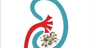وصول نسبة الكرياتينين إلى 3 أو 4 فى البول مؤشر على الفشل الكلوى 
