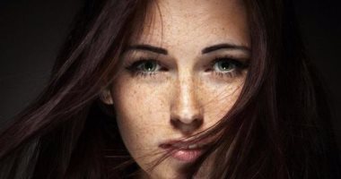 لو شكله بيضايقك.. 3 وصفات طبيعية لتقليل النمش