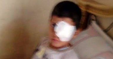 ولى أمر طالب فقعت عينه بدمياط: المدرسة تجبرنى على التصالح