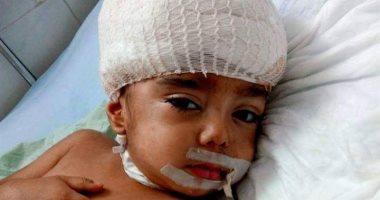 خلافات الضرائر تصيب طفلا بنزيف فى المخ بالشرقية